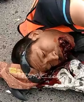 Dying Guy with Extra Hole in the Mouth