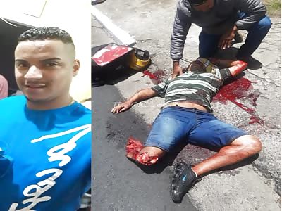 BRUTAL: Motorcyclist Loses Leg in Accident