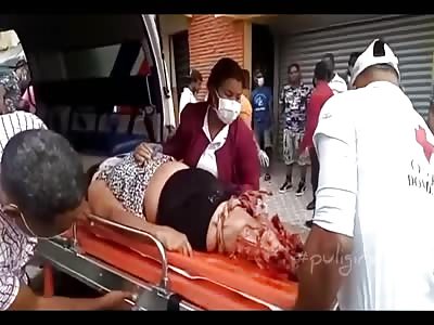 Drugged Driver Hits Mother & Daughter Leaving Mother With Both Legs Amputated