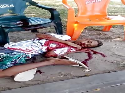 thief in agony after colliding with his motorcycle 