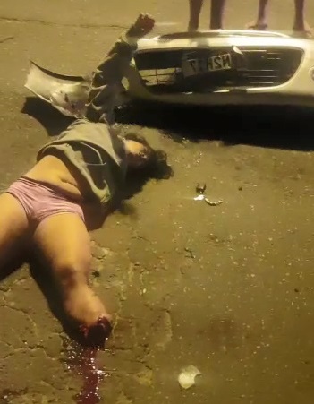 Poor Girl! That Gonna Leave A Limp!