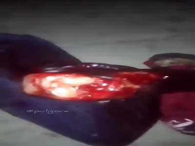 thief in agony after being attacked with machete 