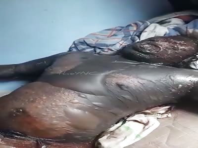 shit man is state of rot