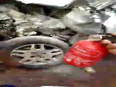 Man with crushed legs in accident calls for help 