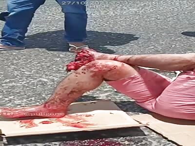 shocking man in agony with shattered leg 