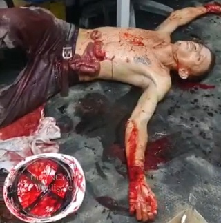 Drunk Man Trying to Hang on With his Guts Hanging Out