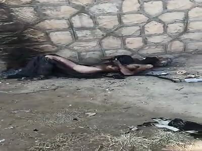 Grandfather found with burns all over the body.