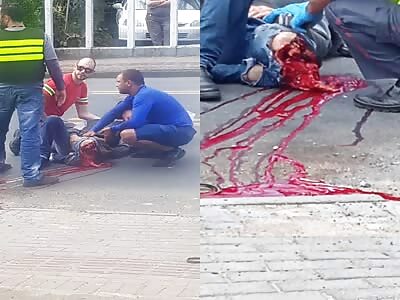 Cctv. motorcyclist is run over where he loses his leg 