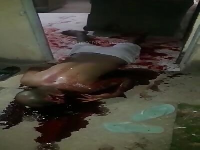 shit man shot in the head 