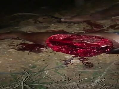 Danm motorcyclist with shattered leg after accident 