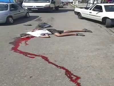 man with crushed head after accident 