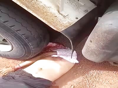 Shocking: Young man with crushed head.