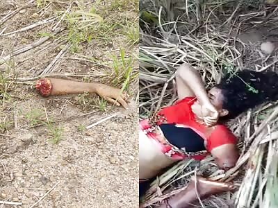 Woman Loses her Arm in Accident