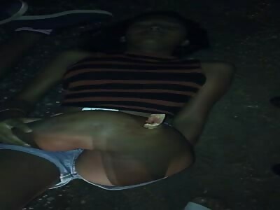 woman with shattered leg after accident