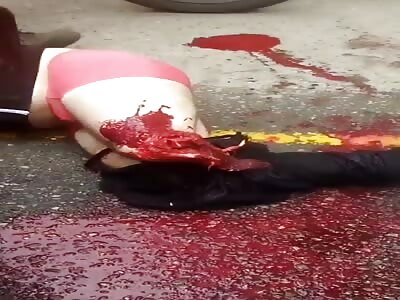 BRUTAL: Biker Loses his Leg.