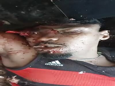 motorcyclist loses his life in an accident