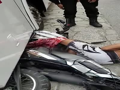 motorcyclist in agony with a shattered leg