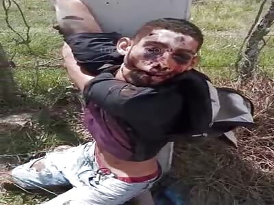 Corpse Found Next to Pole with Tied-Up Hands and Mouth 