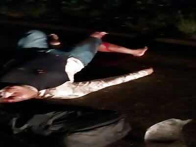 Brutal accident leaves man with broken leg