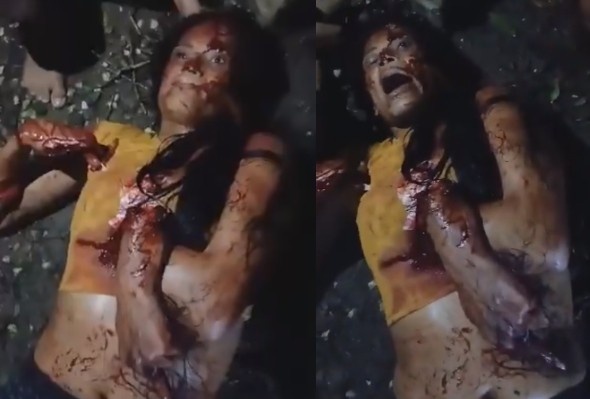 SHOCK: Sicko Attacked And Dismebered His EX With Machete