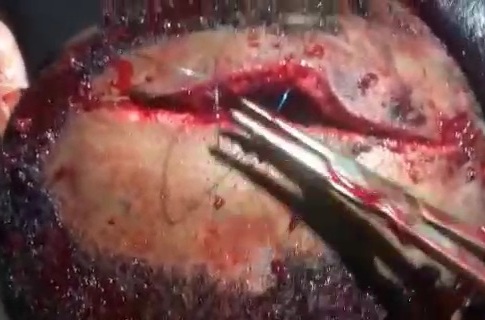 Viking member hospitalized after getting attacked bythe BLACK AXE GANG