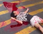 Stabbed Man Takes Last Breath