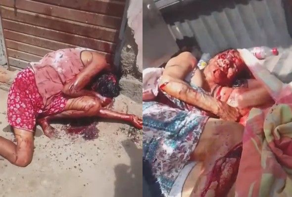 Drug Addict Killed His Mom With Machete In Peru