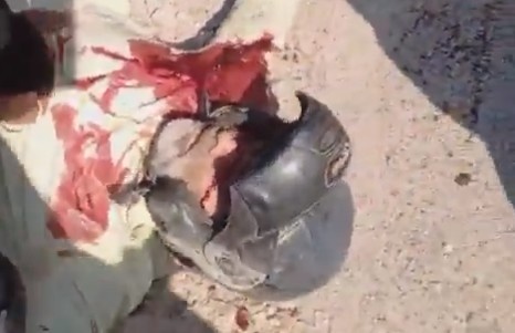 Aftermath Of Car Bomb Explosion In Pakistan