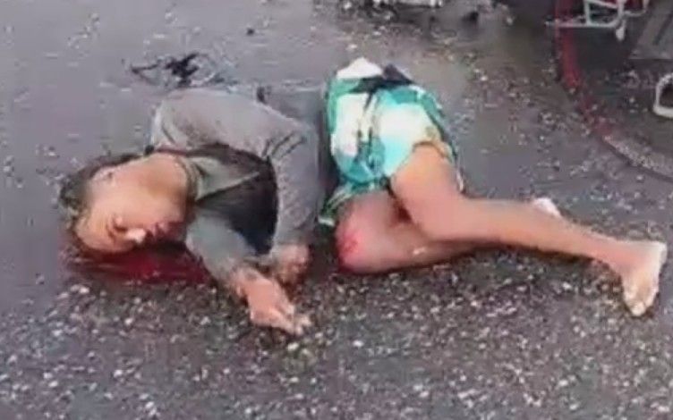 Bleeding Motorcyclist Suffers Seizure After Falling Head First