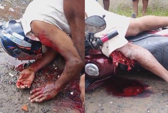 Motorcyclist Suffers Terrible Injuries Fully Awake