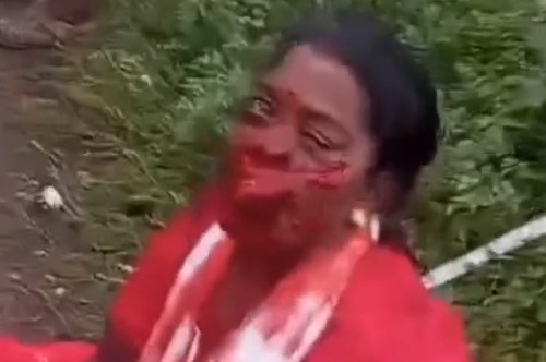 A LOT OF PEOPLE INJURED IN AN ACCIDENT 