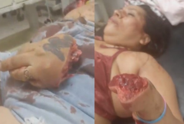 Drunk Man Hacked Wife With Machete After Heated Argument