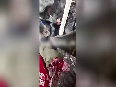 Ukrainian Solider Records The Moment a Mortar Hits His Comrades Arm