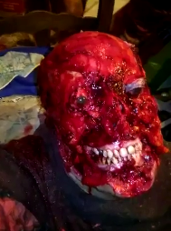 SHOCKING: Horrible Pitbull Attack Leaves Girl With Skinned Face!