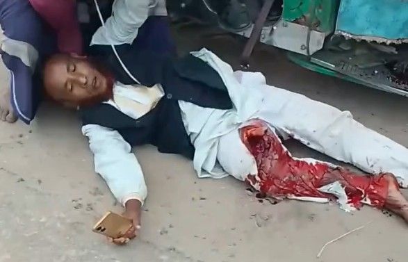 Tuk Tuk vs pedestrian