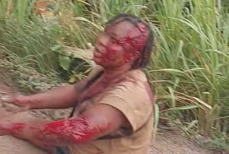 Woman Partially Scalped Following Van Crash In Ghana