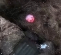 Loose brain (clean & better)