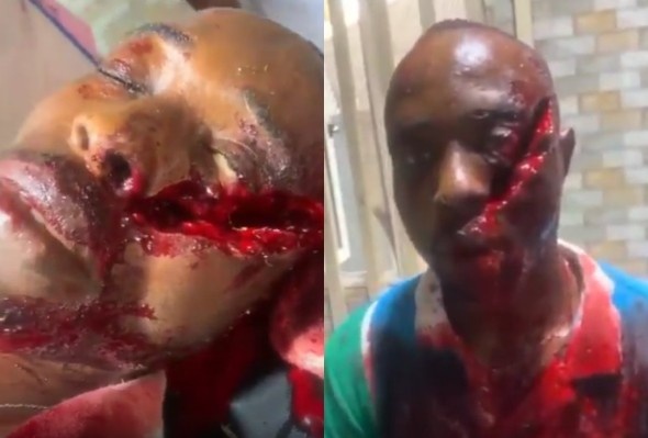 Farmer Attacked With Machete During Land Dispute