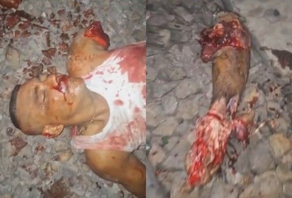 He Definitely Regrets Cycling On Tracks 