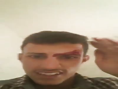 When Your Live Stream is Interrupted by an Airstrike