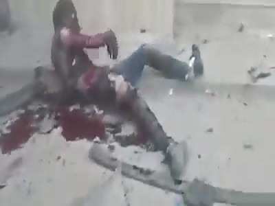 Dead And Wounded Kurds Everywhere After Turkish Airstrike