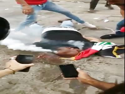 Tear Gas Canister Embedded In Dead Protesters Head