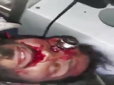 Another Dead Protester With A Tear Gas Canister In The Eye