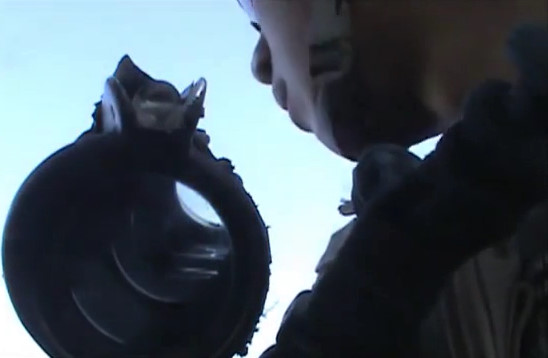 American Soldier Shot In The Neck And Arm In A Firefight With Taliban 