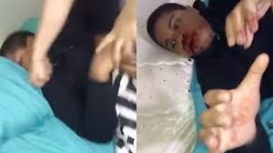 Guy Gets Brutally Beaten Until Brain Damage. All Over A Vape Pen