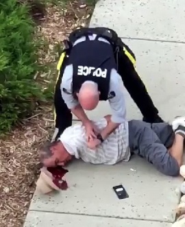 Canadian Tyrant Cowardly Bodyslams Nonviolent White Man, Cracking His Skull