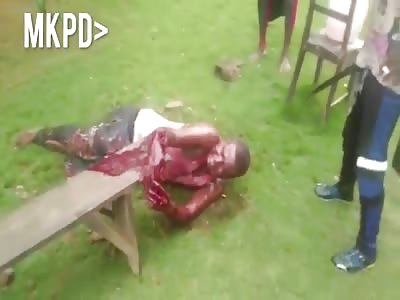 A Man Has His Hand Viciously Hacked Off With A Machete By Terrorists