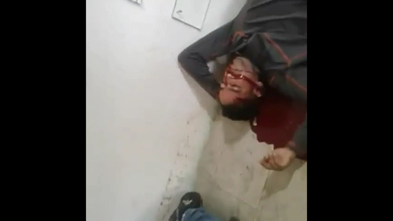 Alleged Extortionist Gets Shot Twice In The Head By Gangsters