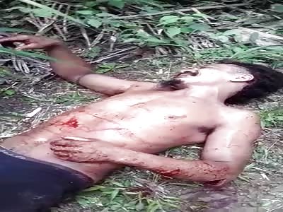 Mullet Man Awaits Medical Help While Onlookers Record 