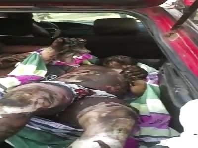 Burn Victim Gets Taken To The Hospital In A Third World Ambulance 